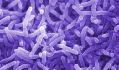 تسببت في وفاة شريكة يوتيوبر شهير.. ما هي بكتيريا الضمة؟