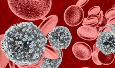 بعد تسجيل 3 إصابات في مراكز تجميل.. مخاوف من انتشار الإيدز في العراق