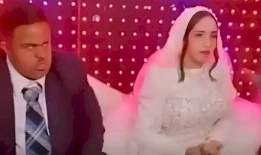 عريس متلازمة داون.. تفاصيل حفل الزفاف المثير للجدل