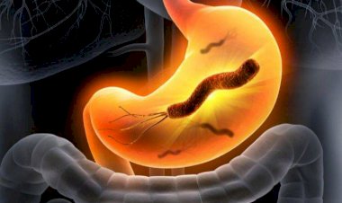 جرثومة المعدة أسبابها وأعراضها وطرق علاجها