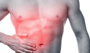 تقرير طبي: أضرار وأسباب ارتفاع إنزيمات الكبد