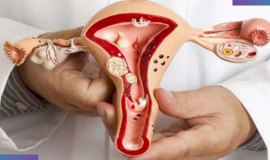 تقرير عن سرطان بطانة الرحم