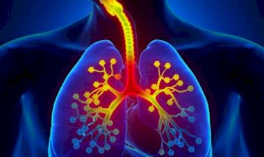 تقرير طبي: التهاب القصبات الهوائية