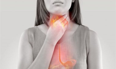 الحموضة والحرقان.. الأسباب و الأعراض و طرق العلاج