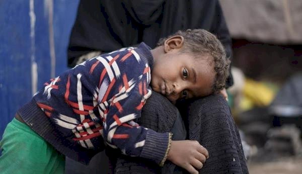 اليمن يختنق إنسانيًا.. مليشيات الحوثي تحكم صنعاء والعالم يتفرج