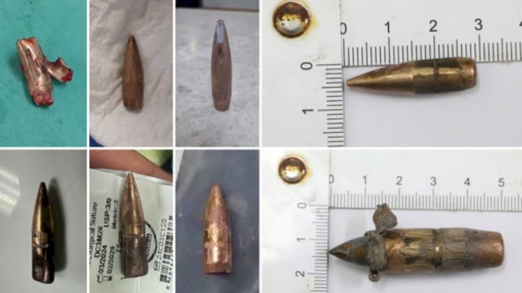 مخطط قاتل.. إطلاق نار إسرائيلي ممنهج على الفلسطينيين أثناء سعيهم للغذاء 