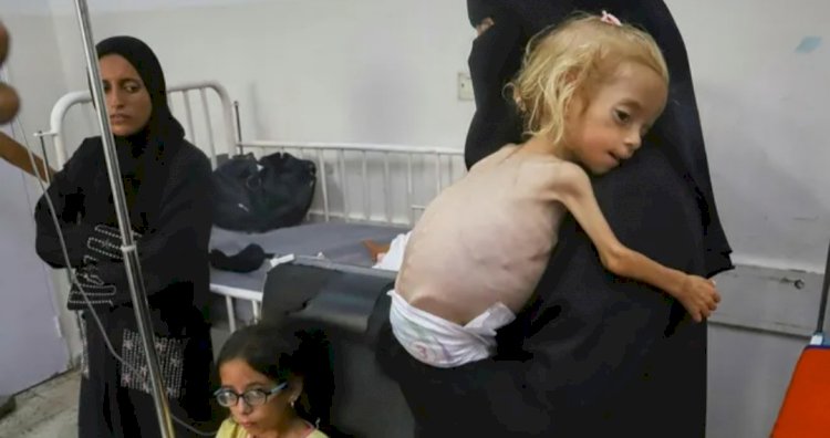 فشل روايات نتنياهو بشأن تكذيب مجاعات غزة.. العالم يكشف الوجه الآخر لإسرائيل