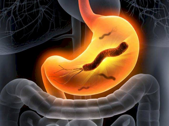 جرثومة المعدة أسبابها وأعراضها وطرق علاجها