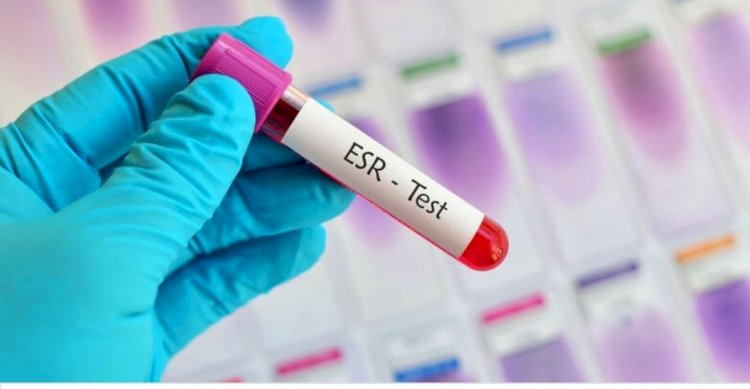 سرعة الترسيب.. متى تتحول من مؤشر عابر إلى ناقوس خطر؟