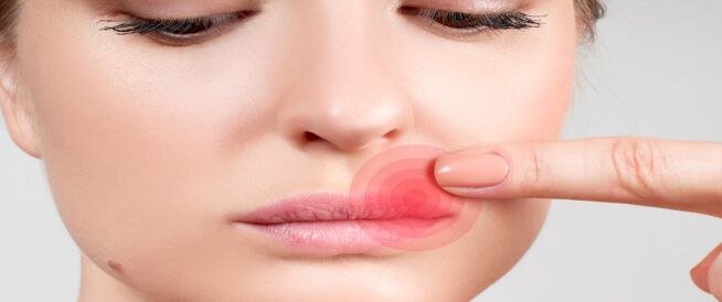 تعرف على أضرار الحبوب حول الفم