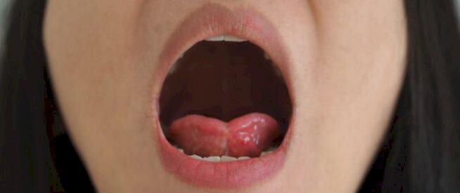 خطورة بلع اللسان وأهمية الإسعاف السريع في إنقاذ الأرواح