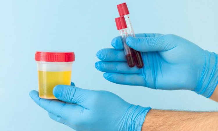 تعرف على علاج زلال البول