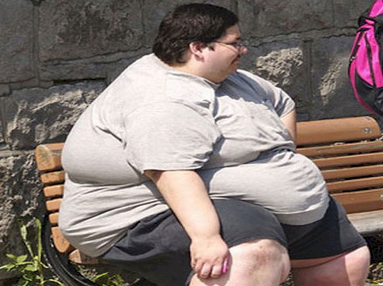 تقرير صحي.. نصائح غذائية وعادات فعالة لعلاج السمنة